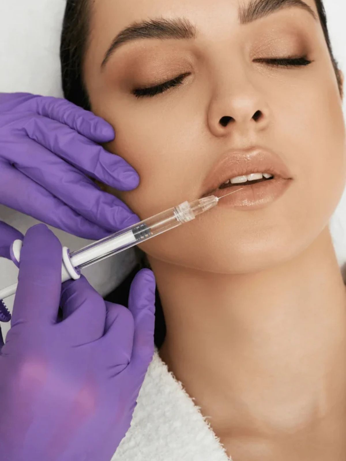 Rascjepi usne i nepca